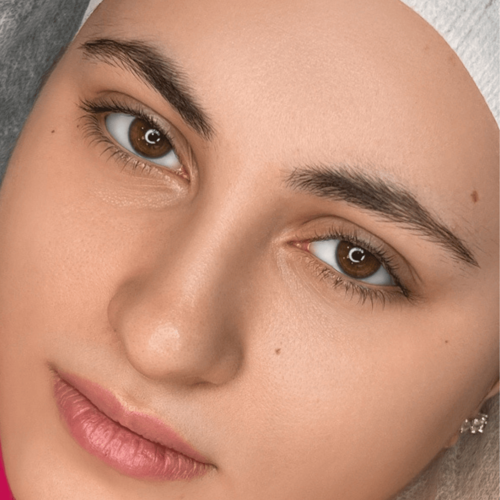 تركش