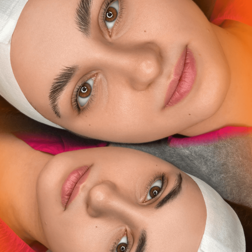  تركش
